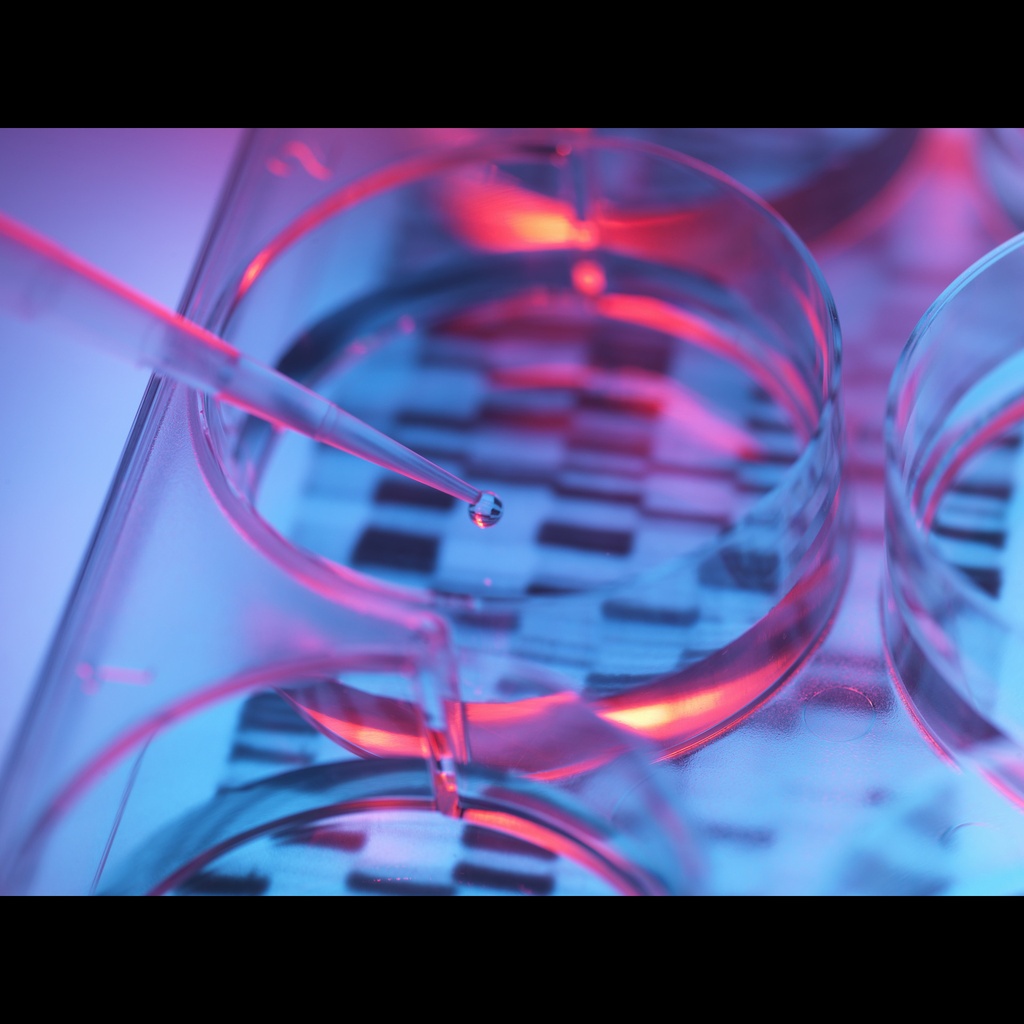 Amplirun® Neisseria Meningitidis Sg A DNA Control size:10,000size:20,000 c/µL